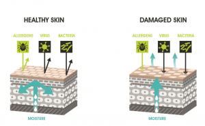 Skin Barrier Diagram